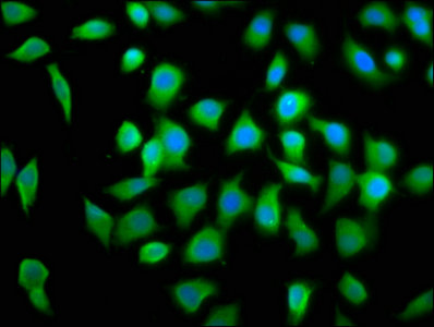 Eif4A2 Polyclonal Antibody - image 5