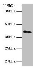 Immunohistochemistry of paraffin-embedded human colon cancer using CAC07419 at dilution of 1:100