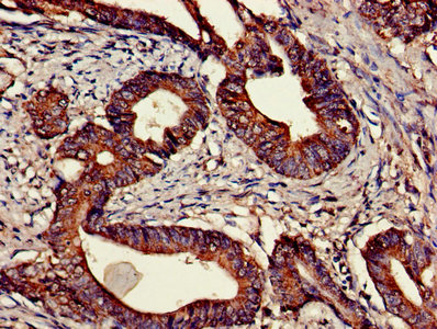 Immunohistochemistry of paraffin-embedded human skeletal muscle tissue using CAC07419 at dilution of 1:100