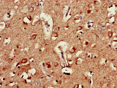 Ap2M1 Polyclonal Antibody - image 3