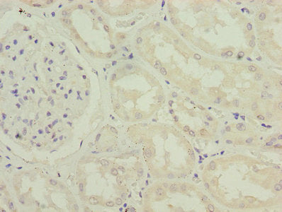 Immunofluorescent analysis of HepG2 cells using CAC07427 at dilution of 1:100 and Alexa Fluor 488-congugated AffiniPure Goat Anti-Rabbit IgG(H+L)
