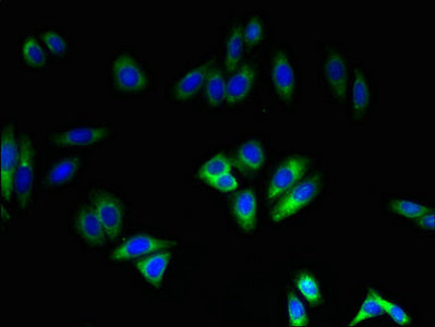 Nox4 Polyclonal Antibody - image 3