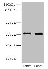 Immunohistochemistry of paraffin-embedded human thyroid tissue using CAC07464 at dilution of 1:100