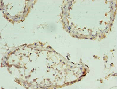 Immunofluorescence staining of Hela cells with CAC07471 at 1:260, counter-stained with DAPI. The cells were fixed in 4% formaldehyde, permeabilized using 0.2% Triton X-100 and blocked in 10% normal Goat Serum. The cells were then incubated with the antibody overnight at 4°C. The secondary antibody was Alexa Fluor 488-congugated AffiniPure Goat Anti-Rabbit IgG(H+L).