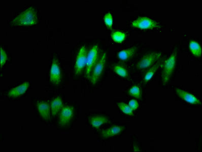 Chac1 Polyclonal Antibody - image 3