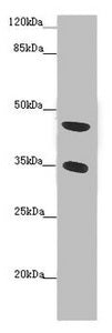 Immunohistochemistry of paraffin-embedded human brain tissue using CAC07476 at dilution of 1:100