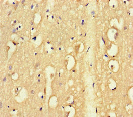 Immunofluorescent analysis of HepG2 cells using CAC07476 at dilution of 1:100 and Alexa Fluor 488-congugated AffiniPure Goat Anti-Rabbit IgG(H+L)