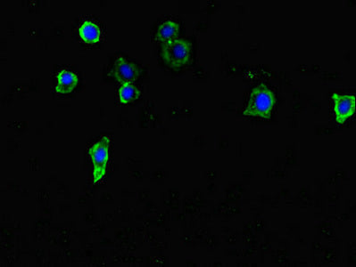 Tent5C Polyclonal Antibody - image 4