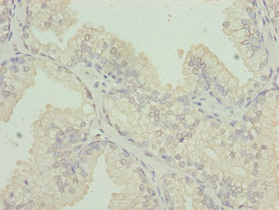 Western blot; ,All lanes: CS antibody at 3µg/ml + HepG2 whole cell lysate; ,Secondary; ,Goat polyclonal to rabbit IgG at 1/10000 dilution; ,Predicted band size: 52 kDa; ,Observed band size: 52 kDa