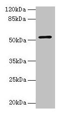 Western Blot; , Positive WB detected in: Zebrafish tissue; , All lanes: CS antibody at 3µg/ml; , Secondary; , Goat polyclonal to rabbit IgG at 1/50000 dilution; , Predicted band size: 52 kDa; , Observed band size: 52 kDa