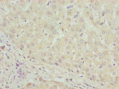 Immunohistochemistry of paraffin-embedded human adrenal gland tissue using CAC07501 at dilution of 1:100