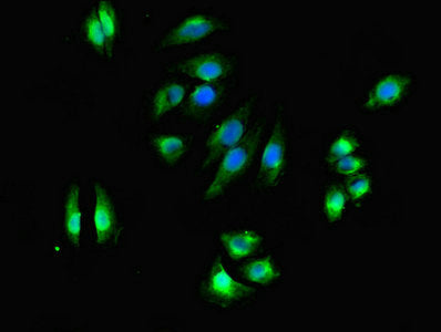 Dhrs3 Polyclonal Antibody - image 5