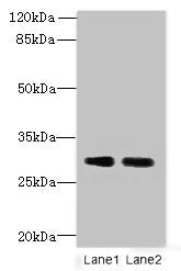 Immunohistochemistry of paraffin-embedded human testis tissue using CAC07502 at dilution of 1:100