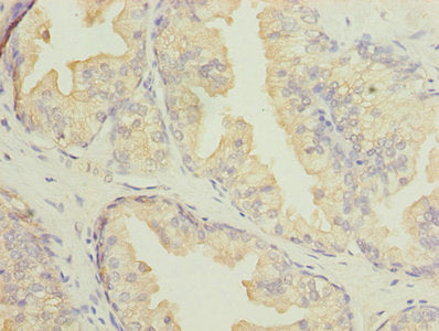 Immunofluorescent analysis of A549 cells using CAC07502 at dilution of 1:100 and Alexa Fluor 488-congugated AffiniPure Goat Anti-Rabbit IgG(H+L)