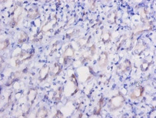 Immunofluorescent analysis of HepG2 cells using CAC07503 at dilution of 1:100 and Alexa Fluor 488-congugated AffiniPure Goat Anti-Rabbit IgG(H+L)