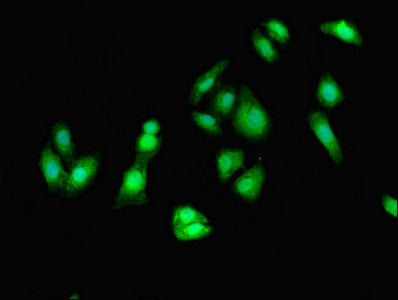 Eef2 Polyclonal Antibody - image 3