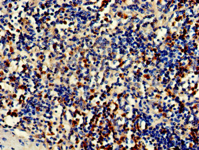 Immunofluorescent analysis of Hela cells using CAC07508 at dilution of 1:100 and Alexa Fluor 488-congugated AffiniPure Goat Anti-Rabbit IgG(H+L)