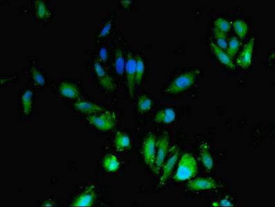 Immunohistochemistry of paraffin-embedded human liver tissue using CAC07508 at dilution of 1:100