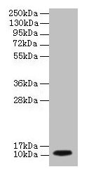 Immunohistochemistry of paraffin-embedded human cervical cancer using CAC07514 at dilution of 1:100