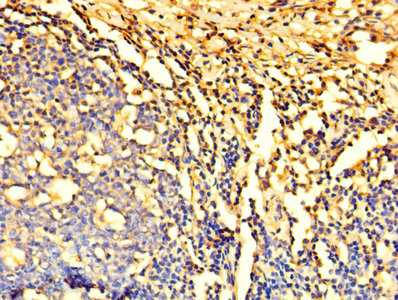 Immunofluorescent analysis of MCF-7 cells using CAC07514 at dilution of 1:100 and Alexa Fluor 488-congugated AffiniPure Goat Anti-Rabbit IgG(H+L)