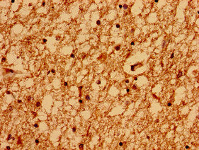 Immunofluorescent analysis of HepG2 cells using CAC07549 at dilution of 1:100 and Alexa Fluor 488-congugated AffiniPure Goat Anti-Rabbit IgG(H+L)