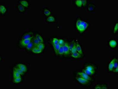 Immunohistochemistry of paraffin-embedded human pancreatic cancer using CAC07549 at dilution of 1:100
