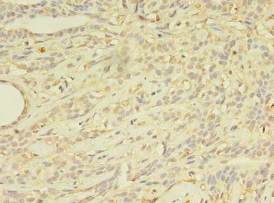 Immunofluorescent analysis of A431 cells using CAC07565 at dilution of 1:100 and Alexa Fluor 488-congugated AffiniPure Goat Anti-Rabbit IgG(H+L)