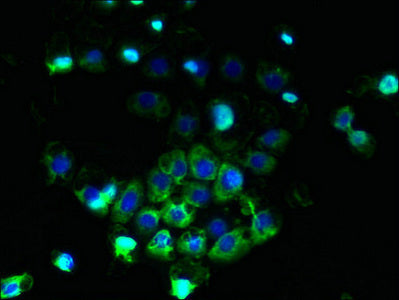 Abcb5 Polyclonal Antibody - image 4