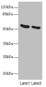 Immunohistochemistry of paraffin-embedded human colon tissue using CAC07568 at dilution of 1:100