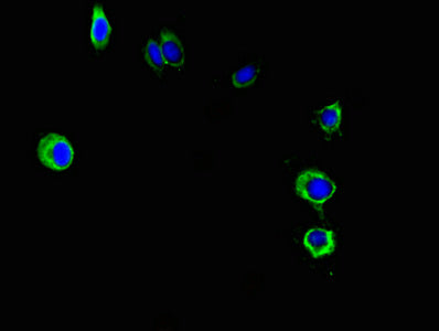 Pnpla2 Polyclonal Antibody - image 4