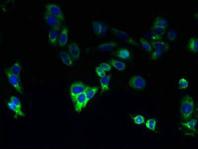 Cyp4F11 Polyclonal Antibody - image 3