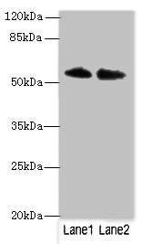 Immunohistochemistry of paraffin-embedded human testis tissue using CAC07578 at dilution of 1:100