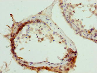 Immunohistochemistry of paraffin-embedded human skeletal muscle tissue using CAC07578 at dilution of 1:100