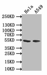 Immunohistochemistry of paraffin-embedded human colon cancer using CAC07587 at dilution of 1:100