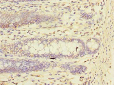 Trim17 Polyclonal Antibody - image 3