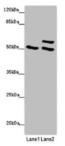 Immunohistochemistry of paraffin-embedded human ovarian cancer using CAC07632 at dilution of 1:100