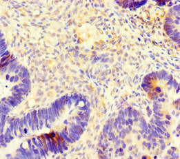 Immunofluorescent analysis of MCF-7 cells using CAC07632 at dilution of 1:100 and Alexa Fluor 488-congugated AffiniPure Goat Anti-Rabbit IgG(H+L)