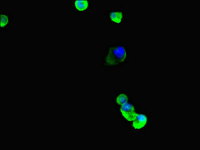 Western Blot; , Positive WB detected in: Hela whole cell lysate, 293 whole cell lysate, K562 whole cell lysate, Mouse brain tissue; , All lanes: TUBB4A antibody at 1:2000; , Secondary; , Goat polyclonal to rabbit IgG at 1/50000 dilution; , Predicted band size: 50 kDa; , Observed band size: 50 kDa;