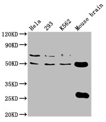 Tubb4A Polyclonal Antibody - image 5