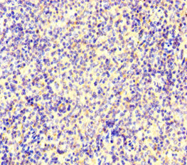 Immunofluorescent analysis of Hela cells using CAC07645 at dilution of 1:100 and Alexa Fluor 488-congugated AffiniPure Goat Anti-Rabbit IgG(H+L)