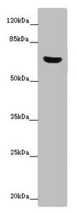 Immunohistochemistry of paraffin-embedded human prostate cancer using CAC07647 at dilution of 1:100