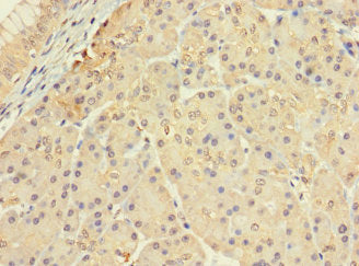 Immunofluorescent analysis of MCF-7 cells using CAC07647 at dilution of 1:100 and Alexa Fluor 488-congugated AffiniPure Goat Anti-Rabbit IgG(H+L)