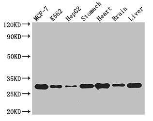 Rabgap1L Polyclonal Antibody - image 4