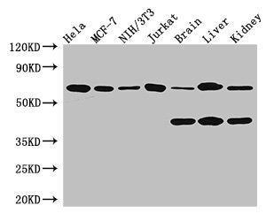 Immunohistochemistry of paraffin-embedded human ovarian cancer using CAC07657 at dilution of 1:100