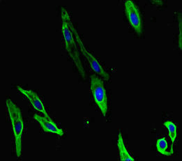 Carm1 Polyclonal Antibody - image 4