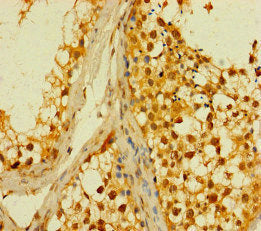 Immunofluorescent analysis of HepG2 cells using CAC07666 at dilution of 1:100 and Alexa Fluor 488-congugated AffiniPure Goat Anti-Rabbit IgG(H+L)