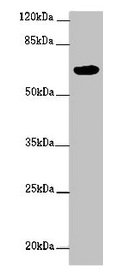 Immunohistochemistry of paraffin-embedded human appendix tissue using CAC07669 at dilution of 1:100
