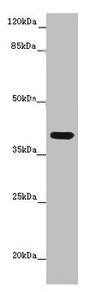Immunohistochemistry of paraffin-embedded human liver tissue using CAC07671 at dilution of 1:100