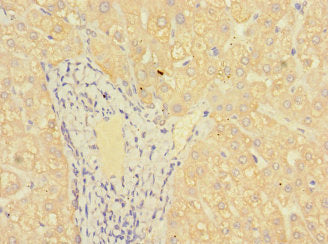Immunohistochemistry of paraffin-embedded human kidney tissue using CAC07671 at dilution of 1:100