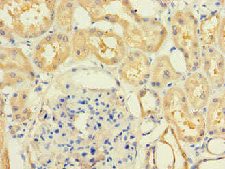 Immunofluorescent analysis of HepG2 cells using CAC07671 at dilution of 1:100 and Alexa Fluor 488-congugated AffiniPure Goat Anti-Rabbit IgG(H+L)